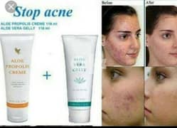 acne free skin 0